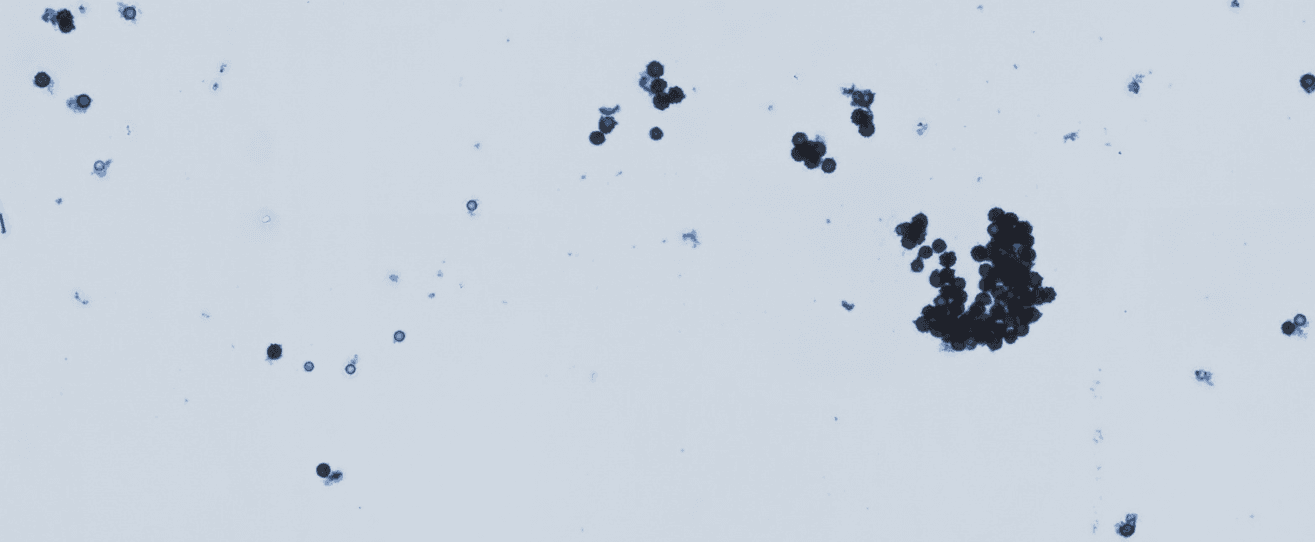 Mold detection example