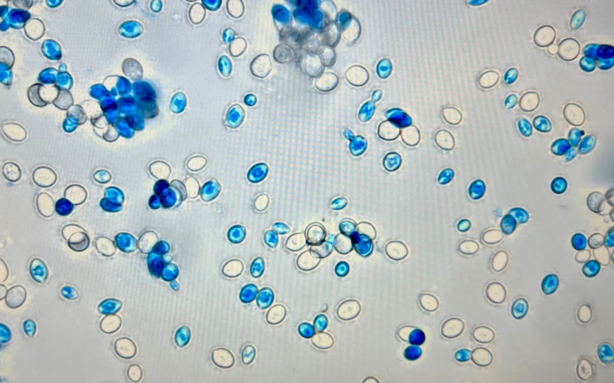 AI-powered microscopy spore identification